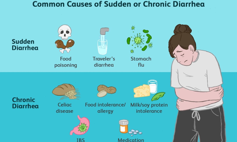 digestive specialist for chronic diarrhea